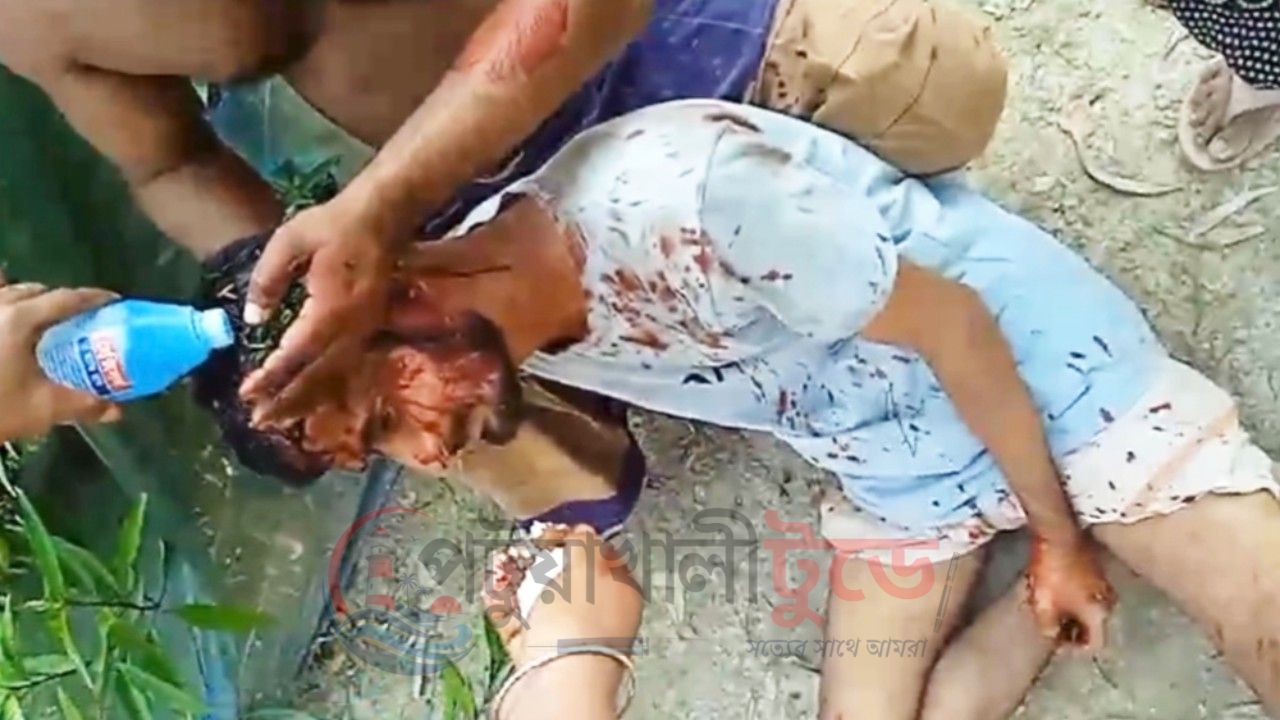 বাউফলে জমিতে সার দিতে গিয়ে দুই ভাইকে কুপিয়ে জখমের অভিযোগ